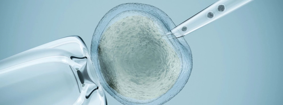 In-Vitro Fertilization (IVF)